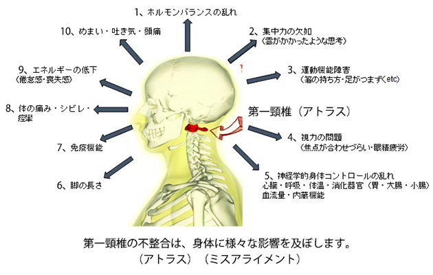 上部頚椎治療について - 頸椎専門治療と波動調整 ヘルシーラボリジュ(Ryju)